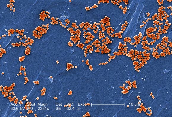 This electron micrograph shows clumps of methicillin-resistant Staphylococcus aureus. Image credit: Janice Haney Carr / Jeff Hageman / USCDCP.
