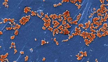 This electron micrograph shows clumps of methicillin-resistant Staphylococcus aureus. Image credit: Janice Haney Carr / Jeff Hageman / USCDCP.