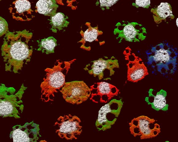 Multicomponent viruses, which separately package different genome segments, were thought to be restricted to plant and fungal hosts. Ladner et al characterize the multicomponent animal virus GCXV and describe an evolutionarily related, segmented virus in a nonhuman primate. This image depicts the presence of different viral RNA segments of GCXV within infected cells. Image credit: Michael Lindquist.