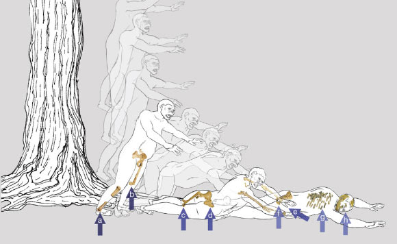 Reconstruction of Lucy’s vertical deceleration event. Kappelman et al hypothesize that Lucy fell from a tall tree, landing feet-first and twisting to the right, with arrows indicating the sequence and types of fractures: (a) pilon fracture, tibial plateau fracture, and spiral shaft fracture of right tibia; (b) the impact of hyperextended left knee drove the distal femoral epiphysis into the distal shaft, and fractured the femoral neck and possibly the acetabulum, sacrum, and lumbar vertebra; (c) the impact of the knee drove the patella into the centre anterodistal surface of the femoral shaft; (d) impact on the right hip drove the right innominate into the sacrum, and the sacrum into the left innominate, dislocating and fracturing the sacrum and left innominate, and elevating the retroauricular surface; (e) Lucy was still conscious when she stretched out her arms in an attempt to break her fall and fractured both proximal humeri, the right more severely than the left with spiral fracture near the midshaft, a Colles’ (or Smith’s) fracture of the right radius, and perhaps other fractures of the radii and ulnae; the impact depressed and retracted the right scapula, which depressed the clavicle into the first rib, fracturing both; (f) frontal impact fractured the left pubis and drove a portion of the anterior inferior pubic ramus posterolaterally, and a branch or rock possibly created the puncture mark on the pubis; (g) the impact of the thorax fractured many ribs and possibly some thoracic vertebrae; (h) the impact of the skull, slightly left of center, created a tripartite guardsman fracture of the mandible and cranial fractures. Image credit: John Kappelman et al, doi: 10.1038/nature19332.