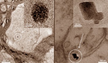 Transmission electron micrographs of brain thin sections, identifying two distinct types of magnetite morphologies: rounded particles (left) and angular particles (right). Image credit: Barbara A. Maher et al, doi: 10.1073/pnas.1605941113.