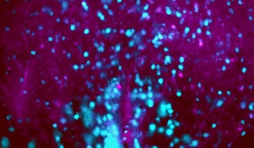 This image shows thirst neurons (blue) in mouse SCN. Image credit: C. Gizowski et al / McGill University.