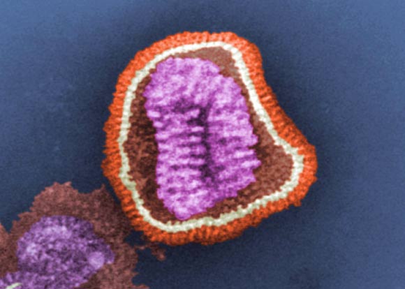 This pseudo-colored negative-stained transmission electron micrograph depicts the ultrastructural details of an influenza virus particle, or ‘virion.’ Image credit: Cynthia Goldsmith / CDC.