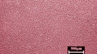 This false-color image shows cardiosphere-derived cells. Image credit: A.J. White et al, doi: 10.1093/eurheartj/ehr172.