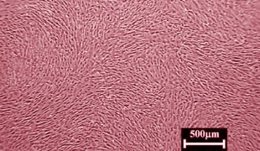 This false-color image shows cardiosphere-derived cells. Image credit: A.J. White et al, doi: 10.1093/eurheartj/ehr172.