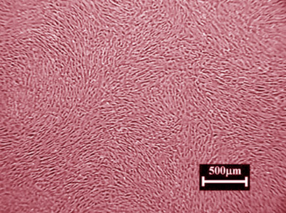 This false-color image shows cardiosphere-derived cells. Image credit: A.J. White et al, doi: 10.1093/eurheartj/ehr172.