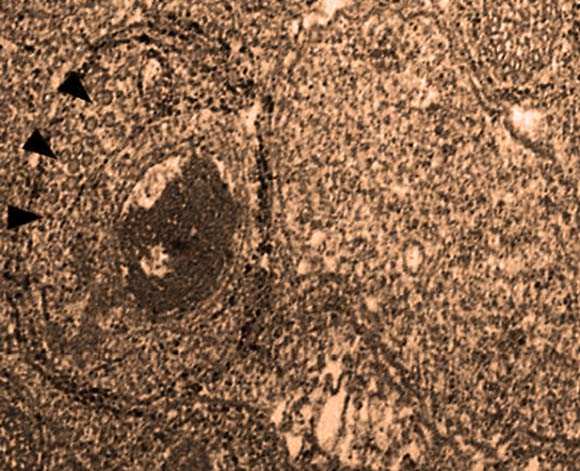 Electron microphotograph shows two Wolbachia cells that have infected a Nasonia wasp. The one to the left is infected with the WO phage, pointed out by the black arrowheads. The one to the right is uninfected. The large dark patch is bacteria DNA that has been degraded by the phage. The image also shows the multiple wasp membranes wrapped around the Wolbachia that the phage must penetrate both to enter and escape from the bacteria. Image credit: Bordenstein Lab, Vanderbilt University.