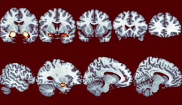 Reduction in sensitivity to dishonesty over time. Image credit: Neil Garrett et al.