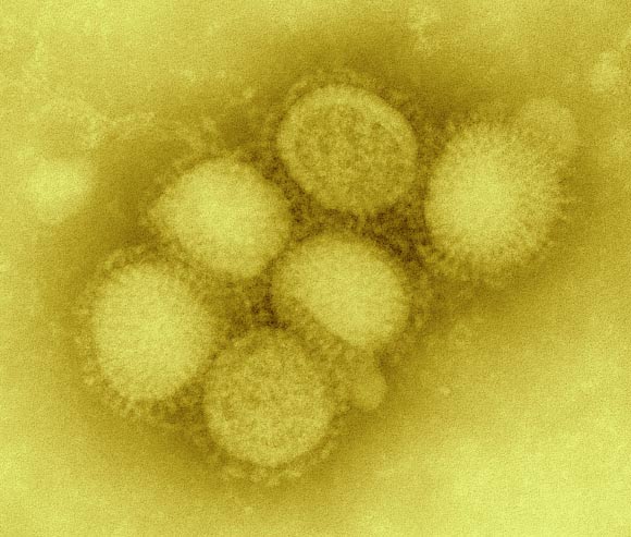 H1N1 influenza virus. Image credit: CDC Influenza Laboratory.