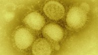 H1N1 influenza virus. Image credit: CDC Influenza Laboratory.
