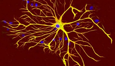 Astrocyte cell. Image credit: Gerry Shaw / CC BY-SA 3.0.