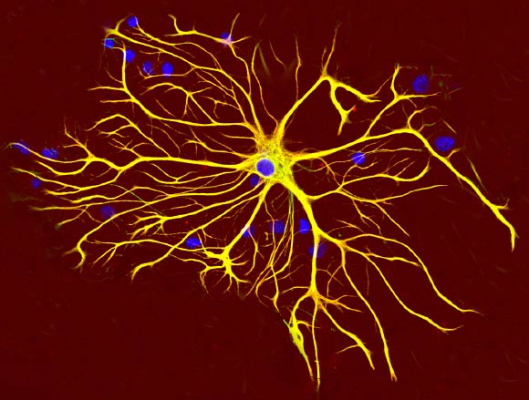Astrocyte cell. Image credit: Gerry Shaw / CC BY-SA 3.0.