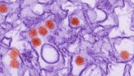 Transmission electron micrograph of Zika virus. Virus particles are 40 nm in diameter, with an outer envelope, and an inner dense core. Image credit: Cynthia Goldsmith / CDC.