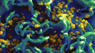 Scanning electron micrograph of HIV particles infecting a human T cell. Image credit: National Institutes of Health.