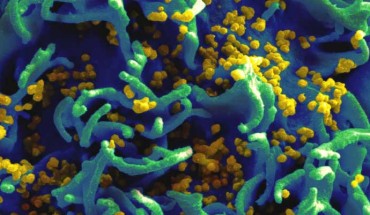Scanning electron micrograph of HIV particles infecting a human T cell. Image credit: National Institutes of Health.