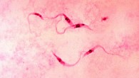 Trypanosoma cruzi, a parasite of the order Kinetoplastida. Image credit: Myron Schultz / CDC.