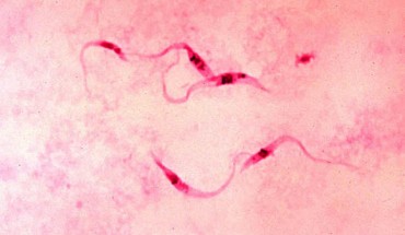 Trypanosoma cruzi, a parasite of the order Kinetoplastida. Image credit: Myron Schultz / CDC.