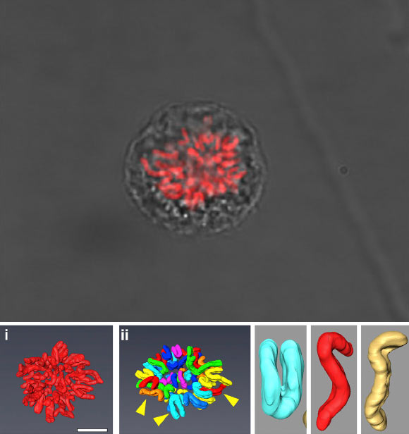 Top: a mitotic RPE (retinal pigment epithelium) cell. Bottom: images show the full chromosome complement (i) and segmented chromosomes (ii); arrows point to examples of individual chromosomes shown in the zoom panels; these include examples of metacentric (cyan) and submetacentric (red, orange) chromosomes. Scale bar - 10 μm. Image credit: Booth et al, doi: 10.1016/j.molcel.2016.10.009.