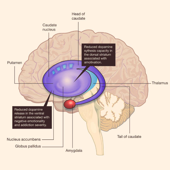 Cannabis use in humans is associated with reduced dopamine in the striatum. PET studies have shown lower striatal dopamine synthesis and release capacity in cannabis users. Lower dopamine synthesis capacity in the dorsal striatum is directly associated with reduced motivation levels, whereas reduced dopamine release in the ventral striatum is directly associated with negative emotion levels and severity of addiction. Image credit: Michael A. P. Bloomfield et al, doi: 10.1038/nature20153.