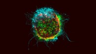 Super-resolution microscopy of GapmeR co-localization with SNX5 protein -- a member of the sorting nexin family of proteins -- in human T-cells. Image credit: Fazil, M. H. U. T. et al, doi: 10.1038/srep37721.