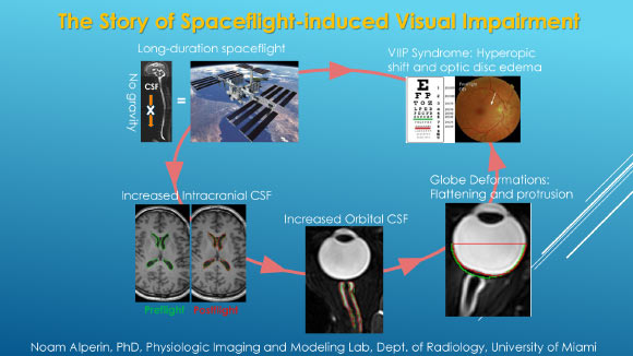 Summary of the spaceflight-induced visual impairment research. Image credit: N. Alperin et al.