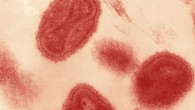This transmission electron micrograph depicts a number of variola virions. Image credit: Fred Murphy & Sylvia Whitfield / CDC.