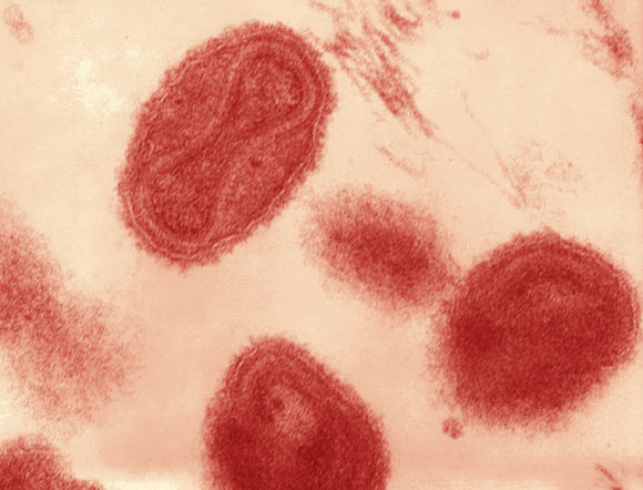 This transmission electron micrograph depicts a number of variola virions. Image credit: Fred Murphy & Sylvia Whitfield / CDC.
