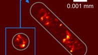 Picture of the distribution of the genetic information in an E. coli cell. Image credit: University of Bielefeld.