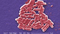 Escherichia coli, a gram-negative bacterium of the genus Escherichia that is commonly found in the lower intestine of warm-blooded organisms. Image credit: CDC.