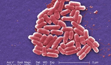 Escherichia coli, a gram-negative bacterium of the genus Escherichia that is commonly found in the lower intestine of warm-blooded organisms. Image credit: CDC.