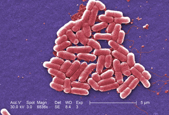 Escherichia coli, a gram-negative bacterium of the genus Escherichia that is commonly found in the lower intestine of warm-blooded organisms. Image credit: CDC.