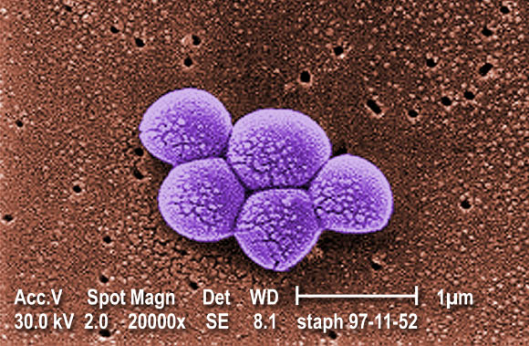 Stephanie M. Reeve et al. identified two plasmid-borne genes that confer high-level resistance to trimethoprim for the first time in MRSA isolates from U.S. hospitals; a series of charged propargyl-linked antifolates overcome this resistance via direct inhibition of the acquired resistance elements. This colorized scanning electron micrograph depicts a grouping of MRSA bacteria. These bacteria are methicillin-resistant, and are from one of the first isolates in the U.S. that showed increased resistance to vancomycin as well. Note the increase in cell wall material seen as clumps on the organisms’ surface. Image credit: Janice Haney Carr / Public Health Image Library / CDC.
