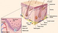 Melanoma is a disease in which malignant cells form in melanocytes. Image credit: Ibdipcan2015 / Terese Winslow / CC BY-SA 4.0.