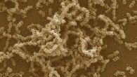 A false-color scanning electron micrograph of G. sulfurreducens-P. aestuarii co-culture. Scale bar - 5 μm. Image credit: Phuc T. Ha et al, doi: 10.1038/ncomms13924.