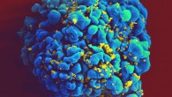 Scanning electromicrograph of an HIV-infected H9 T cell. Image credit: NIAID / CC BY 2.0.