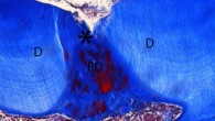 Tideglusib treatment shows complete repair with vital dental pulp after 6 weeks. Image credit: V.C.M. Neves et al, doi: 10.1038/srep39654.