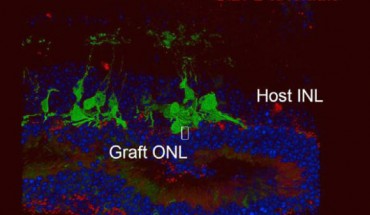 3D observation of contact between host bipolar cells (green) and graft photoreceptors (red). Image credit: RIKEN.