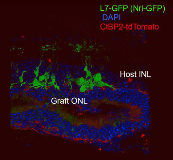 3D observation of contact between host bipolar cells (green) and graft photoreceptors (red). Image credit: RIKEN.
