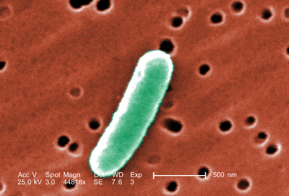 At an extremely high magnification of 44,818x, this colorized scanning electron microscopic (SEM) image reveals some of the morphologic details displayed by Escherichia coli. Image credit: Janice Haney Carr / CDC.