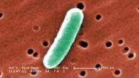 At an extremely high magnification of 44,818x, this colorized scanning electron microscopic (SEM) image reveals some of the morphologic details displayed by Escherichia coli. Image credit: Janice Haney Carr / CDC.