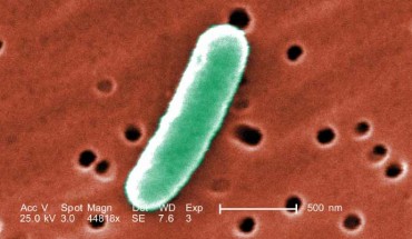 At an extremely high magnification of 44,818x, this colorized scanning electron microscopic (SEM) image reveals some of the morphologic details displayed by Escherichia coli. Image credit: Janice Haney Carr / CDC.