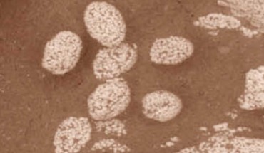 Eggs of the Ordovician trilobite Triarthrus eatoni. Image credit: Thomas A. Hegna et al, doi: 10.1130/G38773.1.