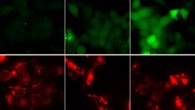 CO2-dependent dye loading of HeLa cells expressing Cx26 from human. The top images (green) show the CO2-dependent loading of 5(6)-CBF at three different levels of PCO2. The Cx26 was tagged at the C-terminal with mCherry. The bottom images (red) in each panel show the mCherry fluorescence and hence Cx26 expression corresponding to the cells that were loaded in the images above. Image credit: Elizabeth de Wolf et al, doi: 10.1098/rspb.2016.2723.
