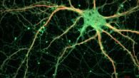 Morrissey et al found that there are specific groups of neurons in the medial prefrontal cortex of a rat’s brain - the region most associated with long-term memory; these neurons develop codes to help store relevant, general information from multiple experiences while, over time, losing the more irrelevant, minor details unique to each experience. This image shows a rat hippocampal neuron. Image credit: ZEISS Microscopy / CC BY 2.0.