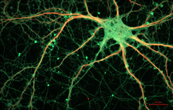 Morrissey et al found that there are specific groups of neurons in the medial prefrontal cortex of a rat’s brain - the region most associated with long-term memory; these neurons develop codes to help store relevant, general information from multiple experiences while, over time, losing the more irrelevant, minor details unique to each experience. This image shows a rat hippocampal neuron. Image credit: ZEISS Microscopy / CC BY 2.0.