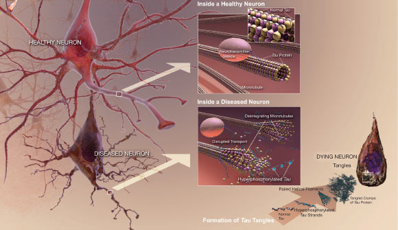 Indiana University Professor Hui-Chen Lu and co-authors have identified 24 compounds that increase the brain’s production of the enzyme NMNAT2, which helps prevent the formation of tau tangles associated with neurodegenerative disorders. Image credit: National Institute on Aging / National Institutes of Health.