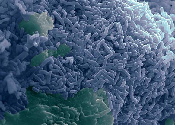 Lactobacillus reuteri bacteria (blue). Image credit: Alistair Walsham & Stephanie Schüller, doi: 10.3389/fmicb.2016.00244.
