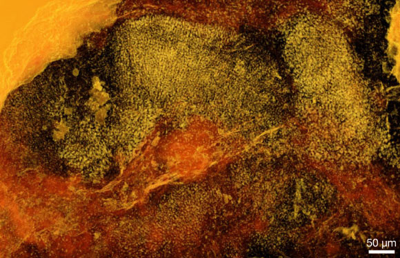 Ramathallus lobatus. Image credit: S. Bengtson et al, doi: 10.1371/journal.pbio.2000735.