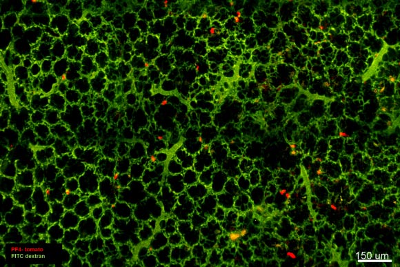 Visualization of resident megakaryocytes in the lungs. Image credit: Emma Lefrançais et al, doi: 10.1038/nature21706.
