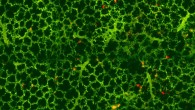 Visualization of resident megakaryocytes in the lungs. Image credit: Emma Lefrançais et al, doi: 10.1038/nature21706.